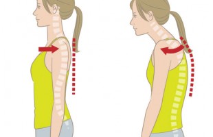 Woman with good posture and rounded shoulders